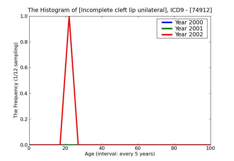ICD9 Histogram Incomplete cleft lip unilateral