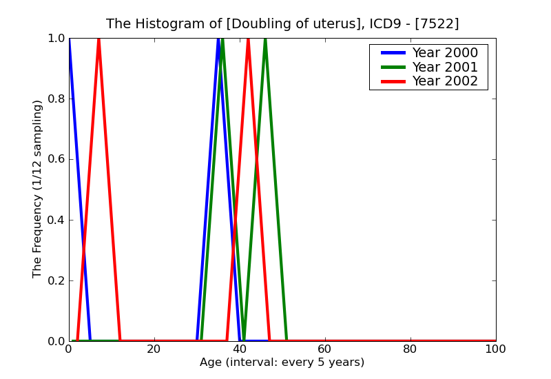 ICD9 Histogram Doubling of uterus