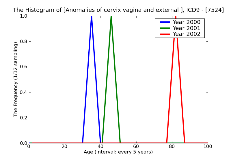 ICD9 Histogram Anomalies of cervix vagina and external female genitalia