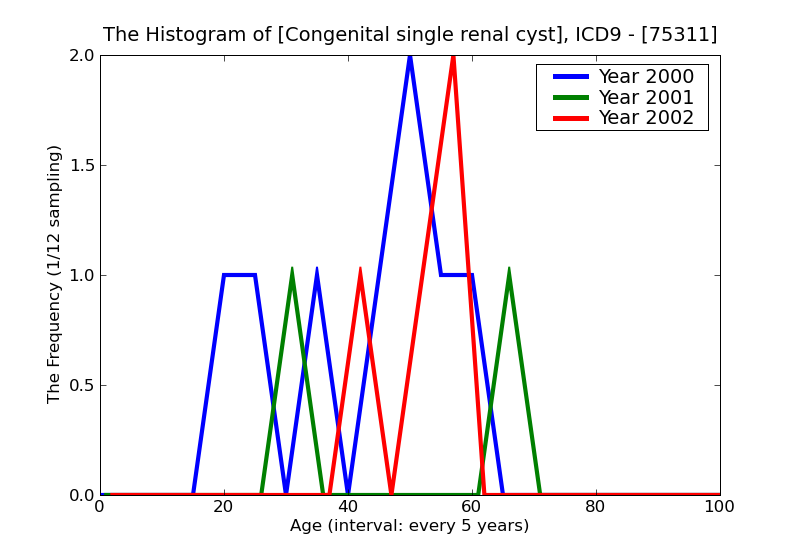 ICD9 Histogram Congenital single renal cyst