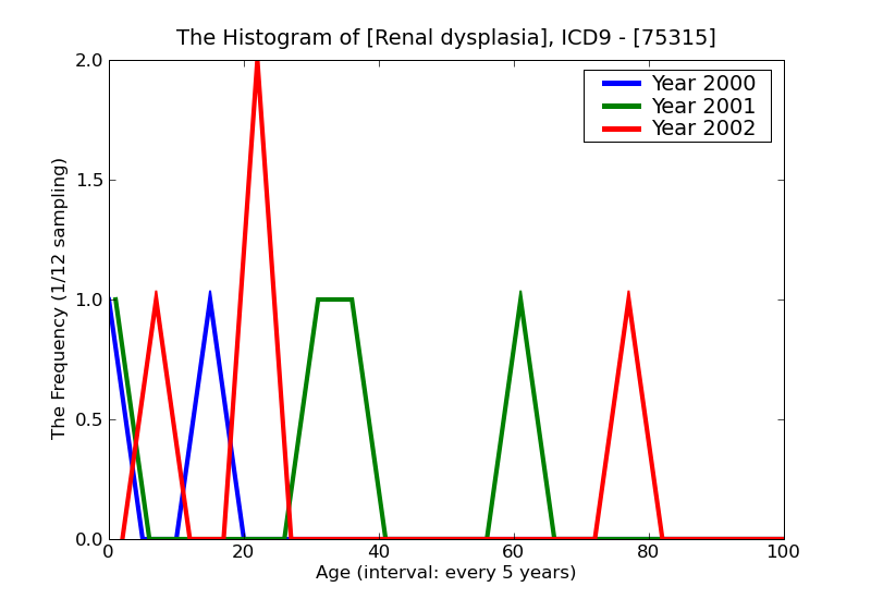 ICD9 Histogram Renal dysplasia