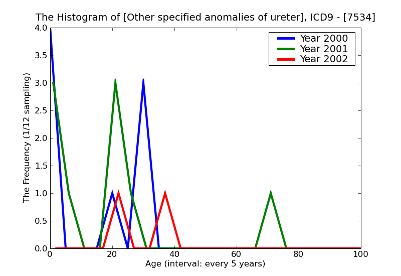 ICD9 Histogram Other specified anomalies of ureter