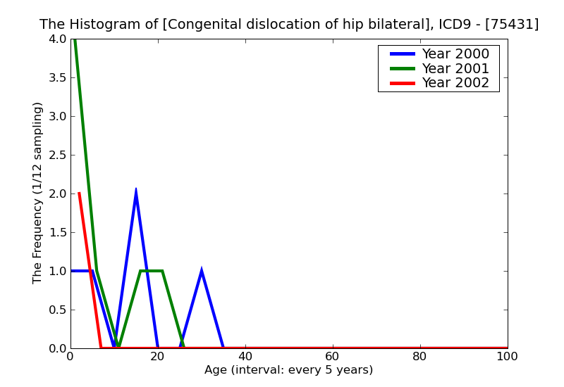 ICD9 Histogram Congenital dislocation of hip bilateral