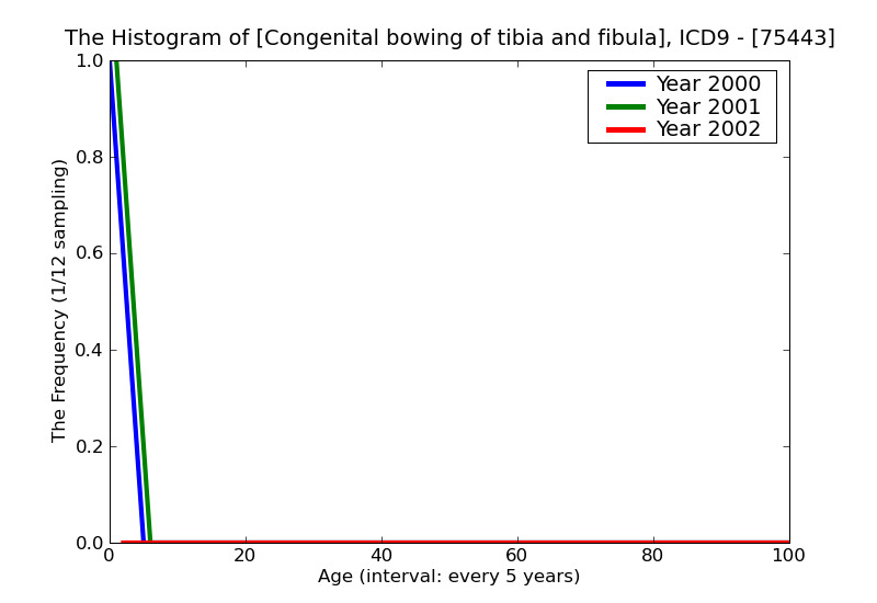 ICD9 Histogram Congenital bowing of tibia and fibula