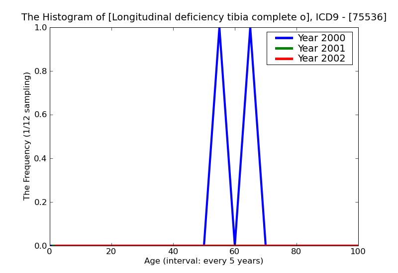 ICD9 Histogram Longitudinal deficiency tibia complete or parital(with or without distal deficiencies incomplete)