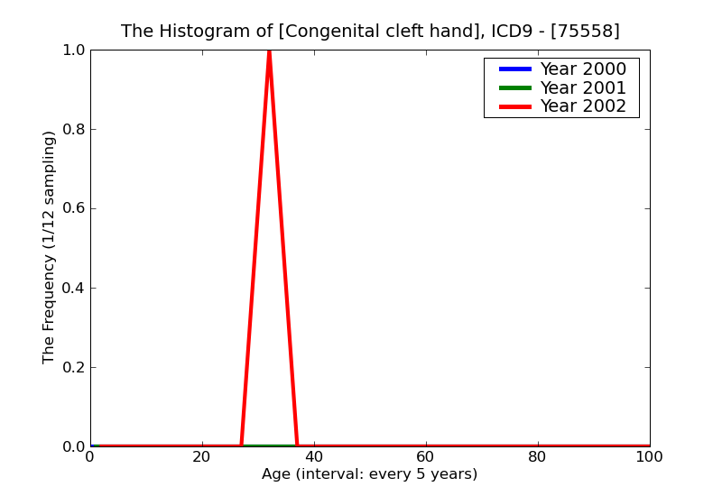 ICD9 Histogram Congenital cleft hand