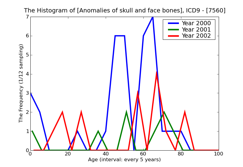 ICD9 Histogram Anomalies of skull and face bones