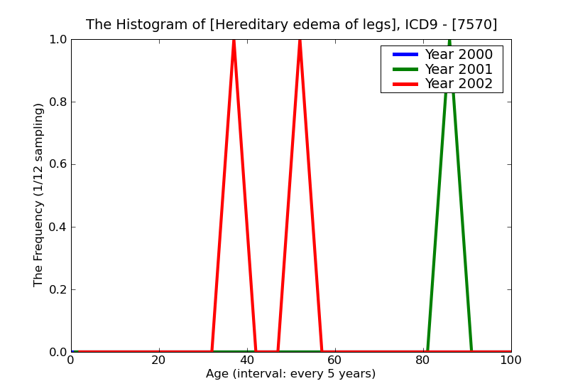 ICD9 Histogram Hereditary edema of legs