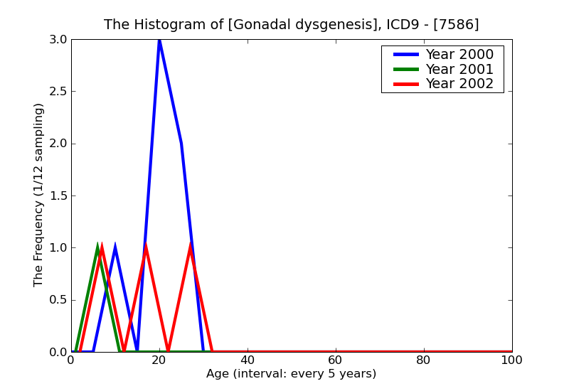 ICD9 Histogram Gonadal dysgenesis