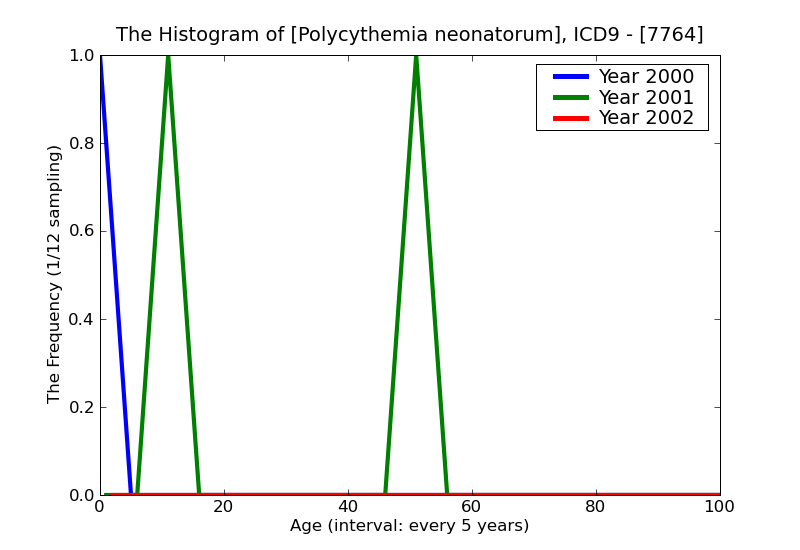 ICD9 Histogram Polycythemia neonatorum