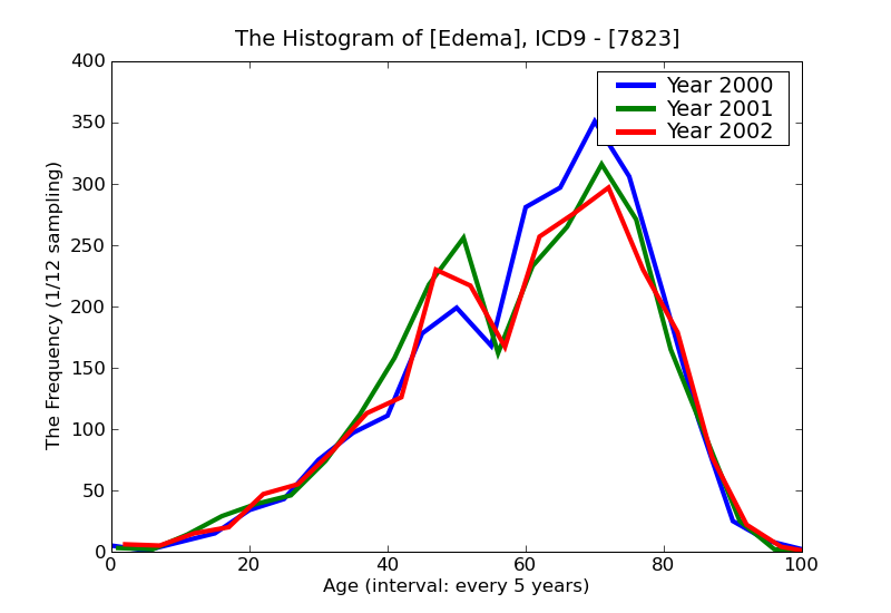 ICD9 Histogram Edema