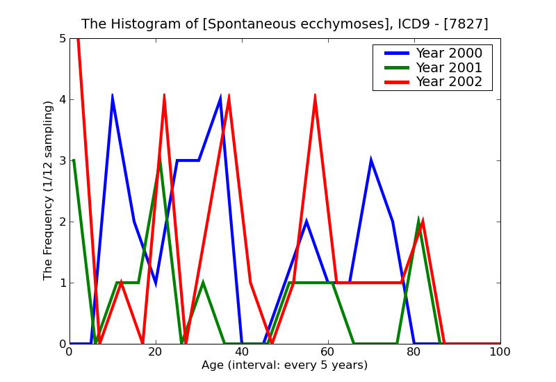 ICD9 Histogram Spontaneous ecchymoses