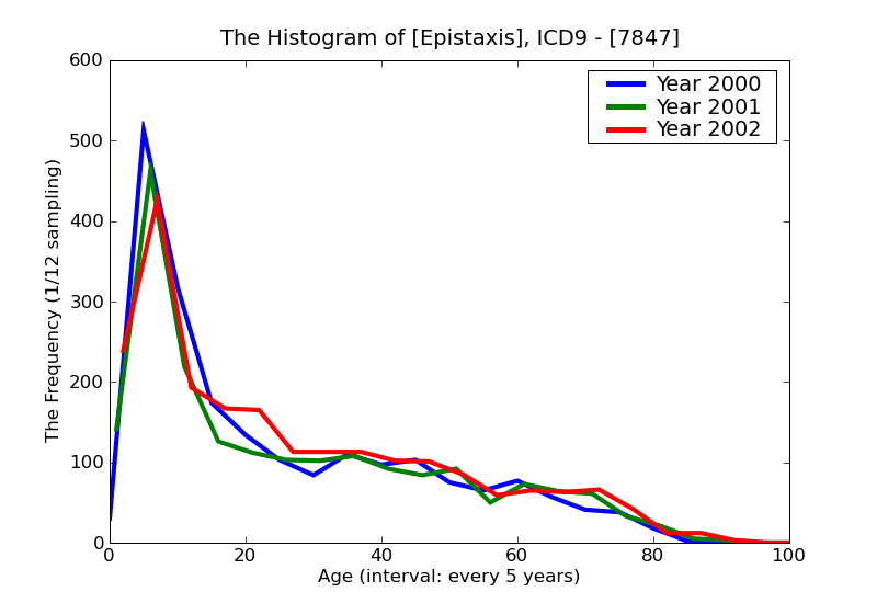 ICD9 Histogram Epistaxis