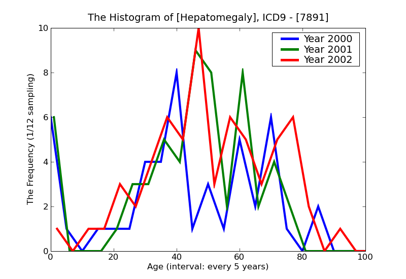ICD9 Histogram Hepatomegaly