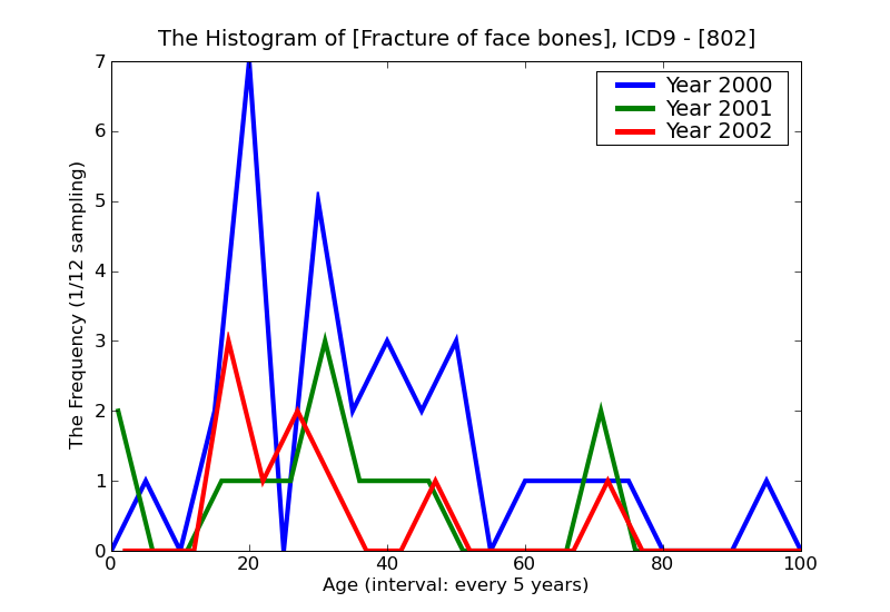 ICD9 Histogram Fracture of face bones