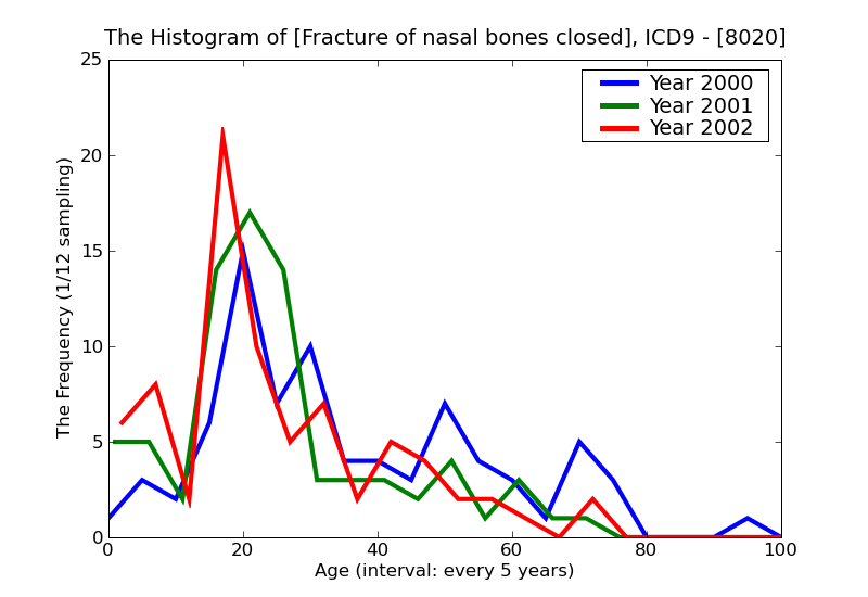 ICD9 Histogram Fracture of nasal bones closed
