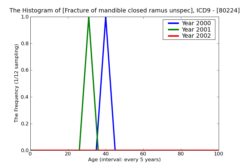 ICD9 Histogram Fracture of mandible closed ramus unspecified