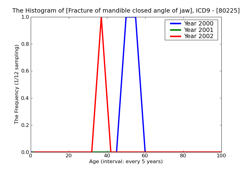 ICD9 Histogram Fracture of mandible closed angle of jaw