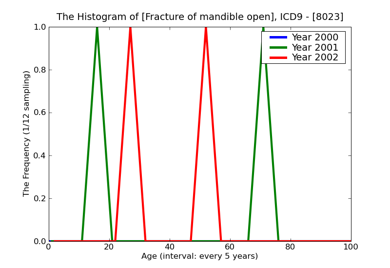 ICD9 Histogram Fracture of mandible open