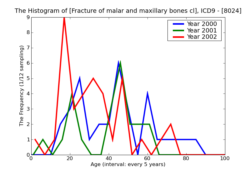 ICD9 Histogram Fracture of malar and maxillary bones closed