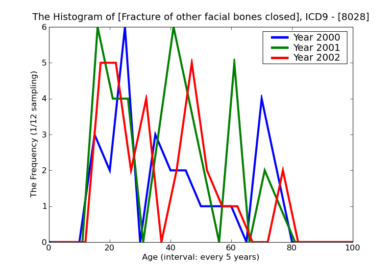 ICD9 Histogram Fracture of other facial bones closed