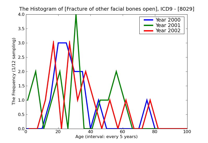 ICD9 Histogram Fracture of other facial bones open