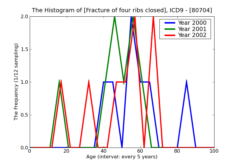 ICD9 Histogram Fracture of four ribs closed