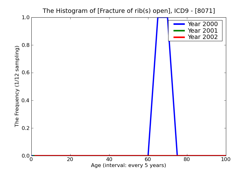 ICD9 Histogram Fracture of rib(s) open