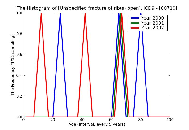 ICD9 Histogram Unspecified fracture of rib(s) open