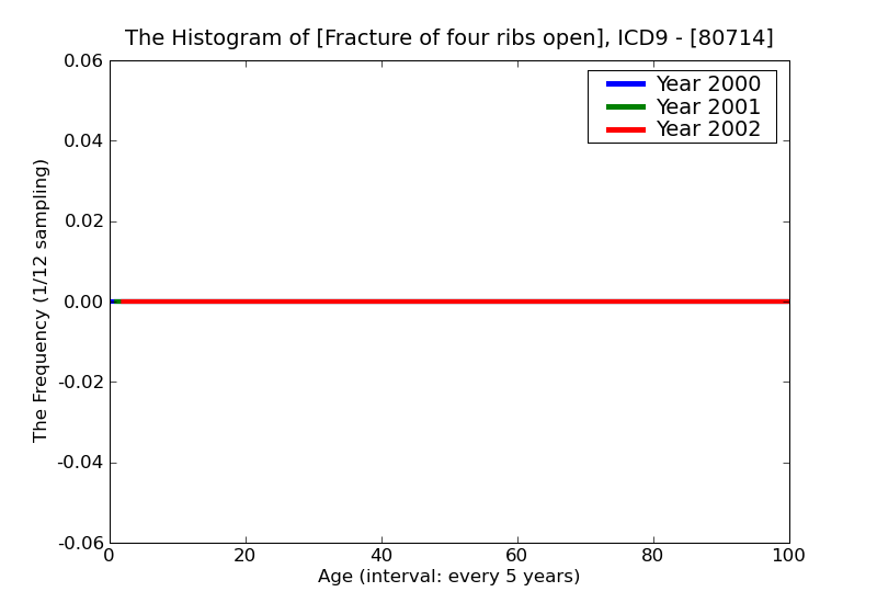 ICD9 Histogram Fracture of four ribs open