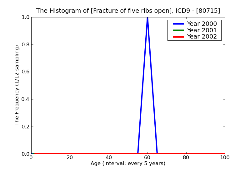 ICD9 Histogram Fracture of five ribs open