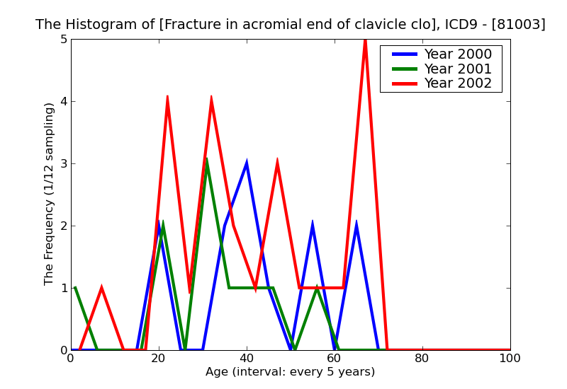 ICD9 Histogram Fracture in acromial end of clavicle closed