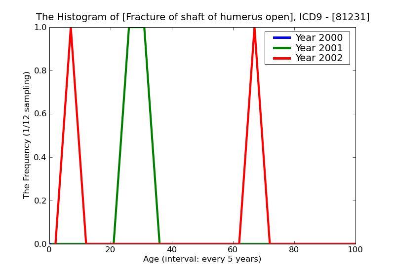 ICD9 Histogram Fracture of shaft of humerus open