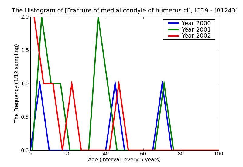 ICD9 Histogram Fracture of medial condyle of humerus closed