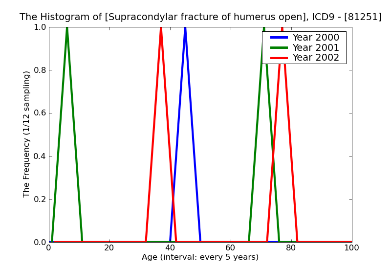 ICD9 Histogram Supracondylar fracture of humerus open