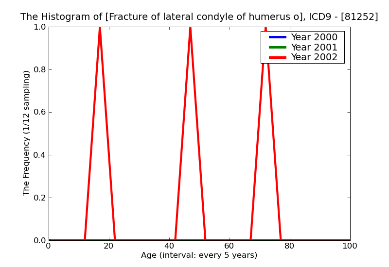 ICD9 Histogram Fracture of lateral condyle of humerus open