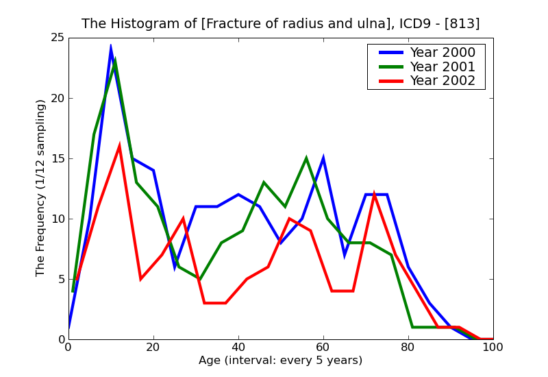 ICD9 Histogram Fracture of radius and ulna