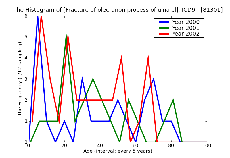 ICD9 Histogram Fracture of olecranon process of ulna closed