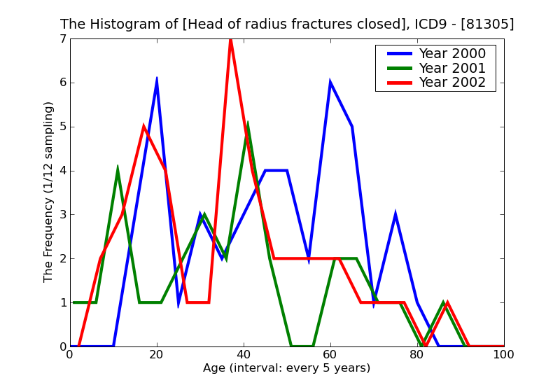 ICD9 Histogram Head of radius fractures closed