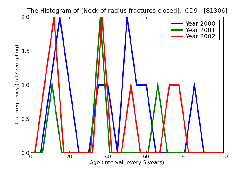 ICD9 Histogram Neck of radius fractures closed