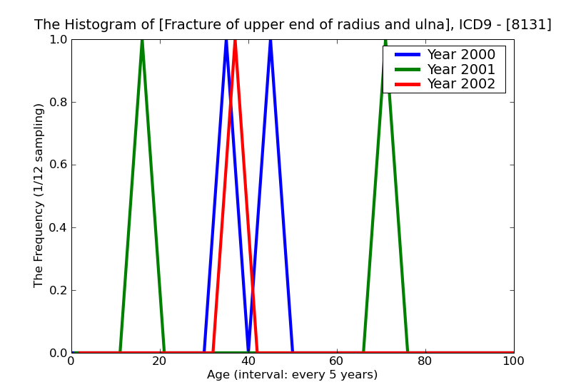ICD9 Histogram Fracture of upper end of radius and ulna open
