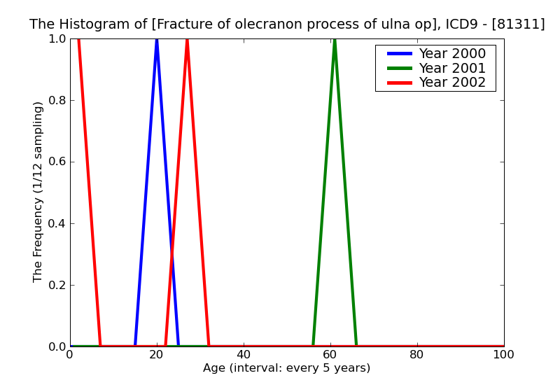 ICD9 Histogram Fracture of olecranon process of ulna open