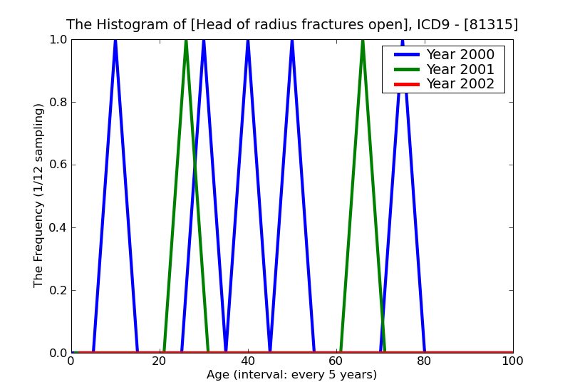 ICD9 Histogram Head of radius fractures open