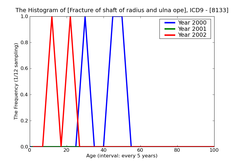ICD9 Histogram Fracture of shaft of radius and ulna open