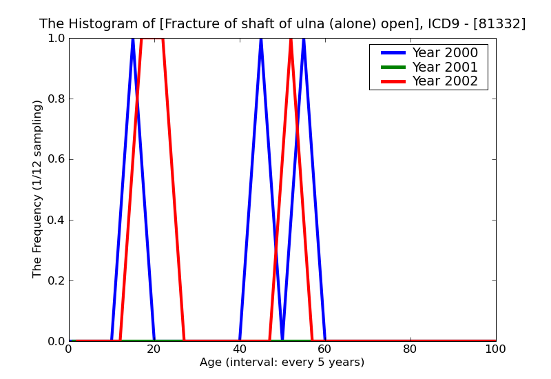 ICD9 Histogram Fracture of shaft of ulna (alone) open