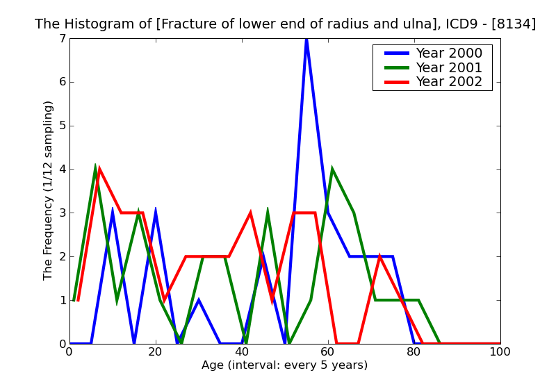 ICD9 Histogram Fracture of lower end of radius and ulna closed