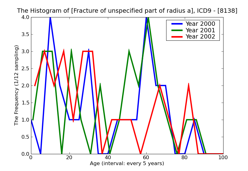 ICD9 Histogram Fracture of unspecified part of radius and ulna closed