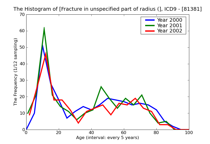 ICD9 Histogram Fracture in unspecified part of radius (alone) closed