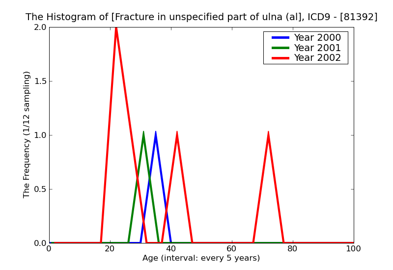 ICD9 Histogram Fracture in unspecified part of ulna (alone) open