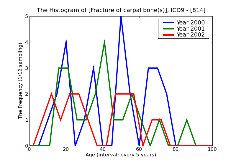 ICD9 Histogram Fracture of carpal bone(s)